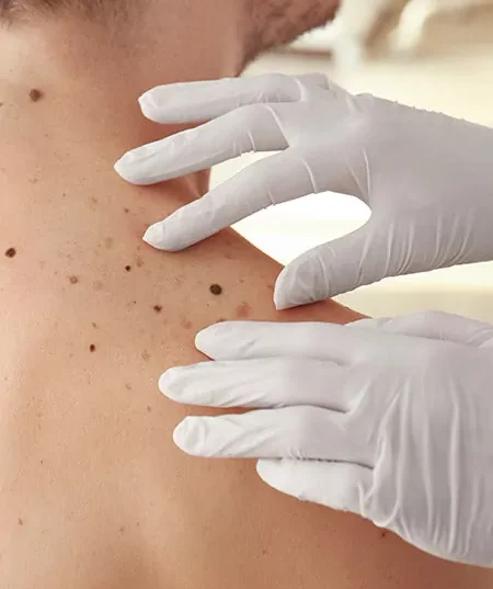Skin-Problem